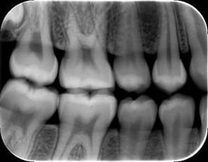 Pricing, List, Bitewing radiographs, DoniDent Dental Clinic