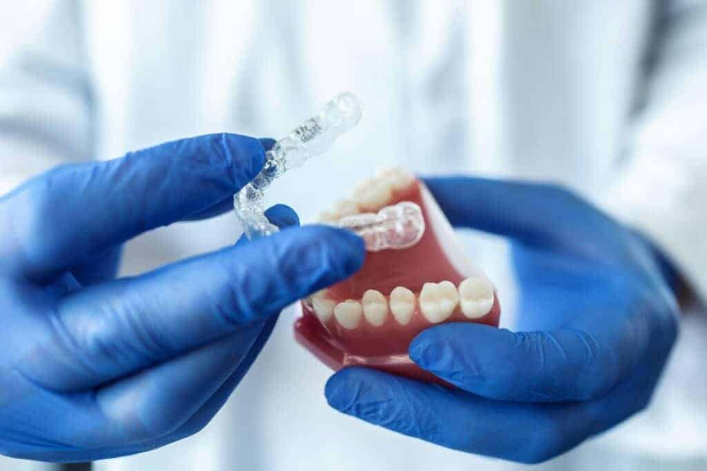 doctor hold an artificial model of the jaw with invisible braces. donident, dental clinic