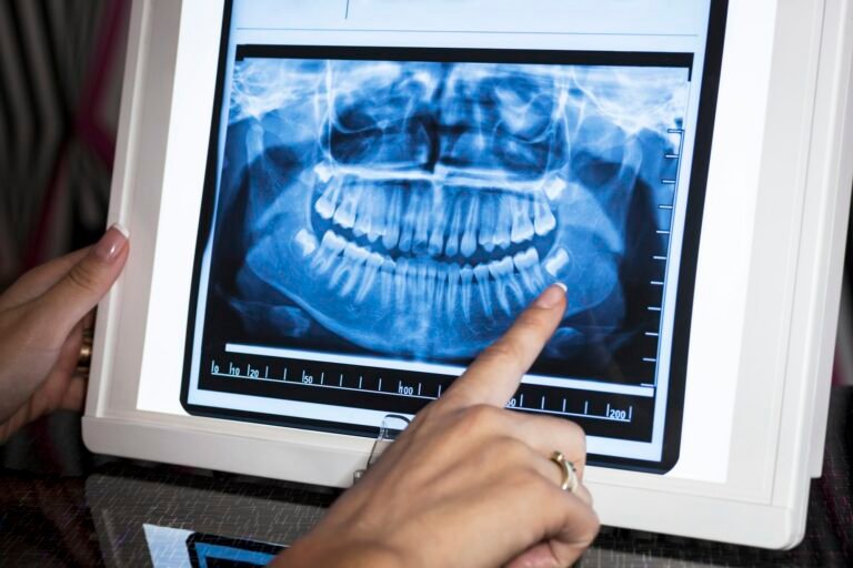 Panoramic x-ray, DoniDent Dental Clinic