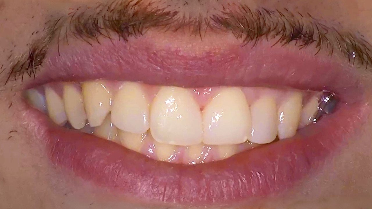 After Dental Care Offer DoniDent