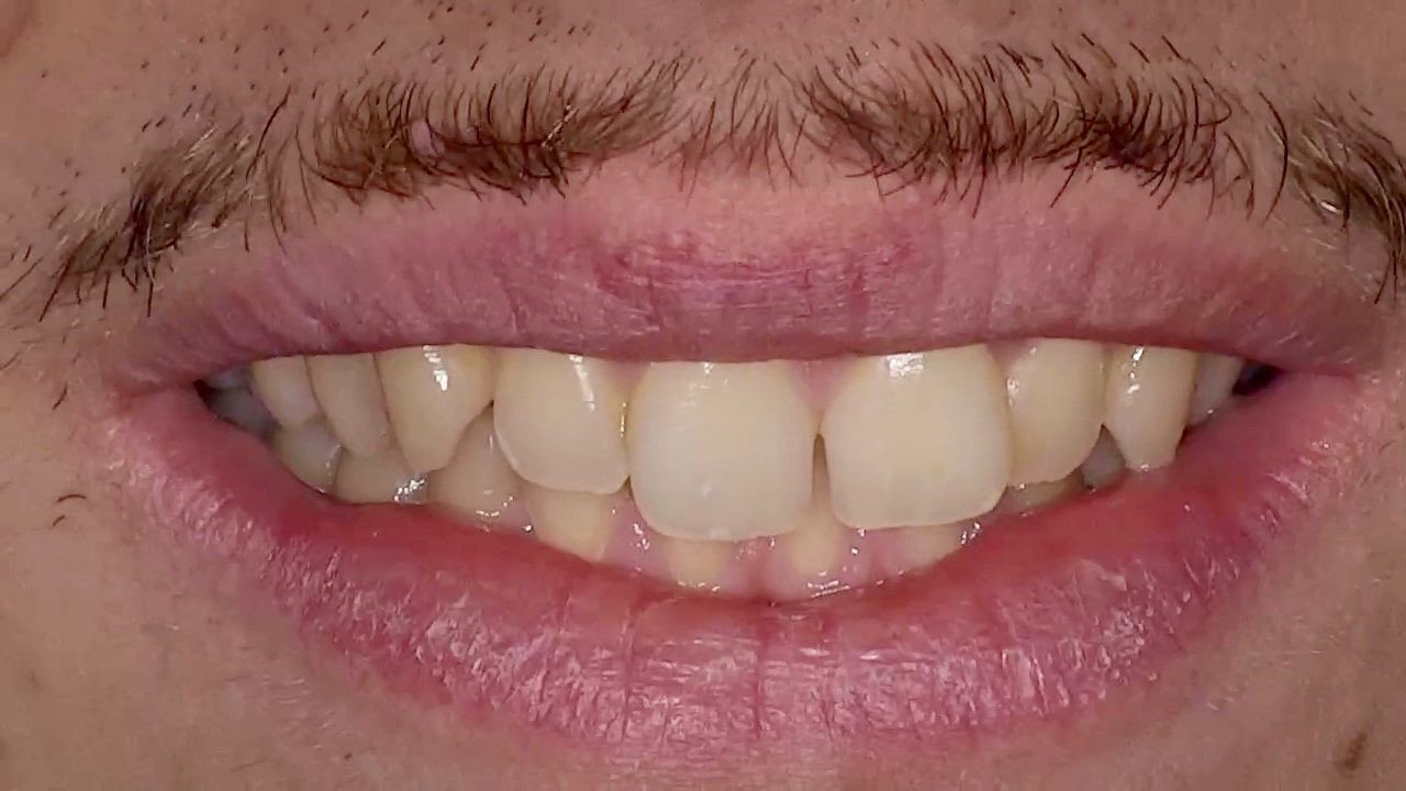 Before Dental Care Offer DoniDent Before Dental Care Offer DoniDent